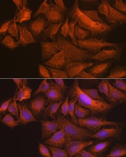 Invitrogen TBK1 Recombinant Rabbit Monoclonal Antibody (4G6C7) 100 &mu;L;