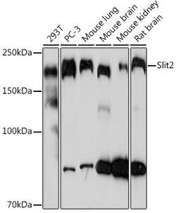 Invitrogen SLIT2 Recombinant Rabbit Monoclonal Antibody (1T5A3) 100 &mu;L;