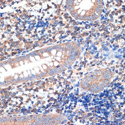 Invitrogen CRMP5 Recombinant Rabbit Monoclonal Antibody (5L4S8) 100 &mu;L;