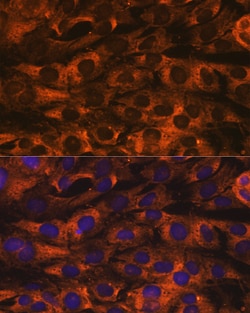 Invitrogen YBX1 Recombinant Rabbit Monoclonal Antibody (9J7M4) 100 &mu;L;