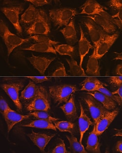 Invitrogen YBX1 Recombinant Rabbit Monoclonal Antibody (9J7M4) 100 &mu;L;
