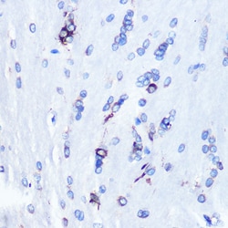 Invitrogen YBX1 Recombinant Rabbit Monoclonal Antibody (9J7M4) 100 &mu;L;
