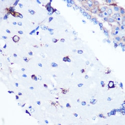 Invitrogen YBX1 Recombinant Rabbit Monoclonal Antibody (9J7M4) 100 &mu;L;