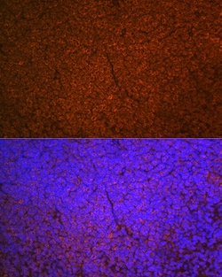 Invitrogen SHIP1 Recombinant Rabbit Monoclonal Antibody (2F8U0) 100 &mu;L;