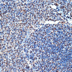 Invitrogen CD264 (TRAIL-R4) Recombinant Rabbit Monoclonal Antibody (10Y1N4)
