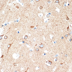 Invitrogen CD264 (TRAIL-R4) Recombinant Rabbit Monoclonal Antibody (10Y1N4)