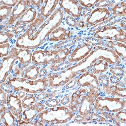 Invitrogen CD264 (TRAIL-R4) Recombinant Rabbit Monoclonal Antibody (10Y1N4)