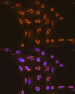 Invitrogen APC6 Recombinant Rabbit Monoclonal Antibody (7Y1Y10) 100 &mu;L;