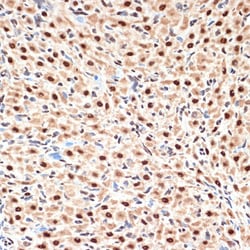 Invitrogen APC6 Recombinant Rabbit Monoclonal Antibody (7Y1Y10) 100 &mu;L;
