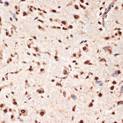 Invitrogen APC6 Recombinant Rabbit Monoclonal Antibody (7Y1Y10) 100 &mu;L;
