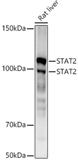 Invitrogen STAT2 Recombinant Rabbit Monoclonal Antibody (4A5P8) 100 &mu;L;