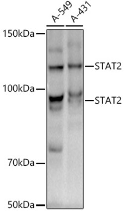Invitrogen STAT2 Recombinant Rabbit Monoclonal Antibody (4A5P8) 100 &mu;L;