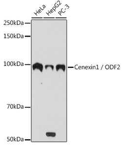 Invitrogen ODF2 Recombinant Rabbit Monoclonal Antibody (3Z1H8) 100 &mu;L;