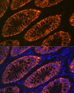 Invitrogen A33 Recombinant Rabbit Monoclonal Antibody (9W5A7) 100 &mu;L | Buy Online | Invitrogen&trade; | Fisher Scientific