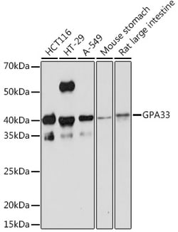 Invitrogen A33 Recombinant Rabbit Monoclonal Antibody (9W5A7) 100 &mu;L | Buy Online | Invitrogen&trade; | Fisher Scientific