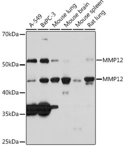 Invitrogen MMP12 Recombinant Rabbit Monoclonal Antibody (1O3A4) 100 &mu;L;