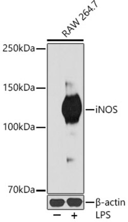 Invitrogen iNOS Recombinant Rabbit Monoclonal Antibody (3L0U6) 100 &mu;L | Buy Online | Invitrogen&trade; | Fisher Scientific