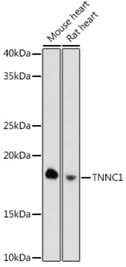Invitrogen Cardiac Troponin C Recombinant Rabbit Monoclonal Antibody (8Z4V9)