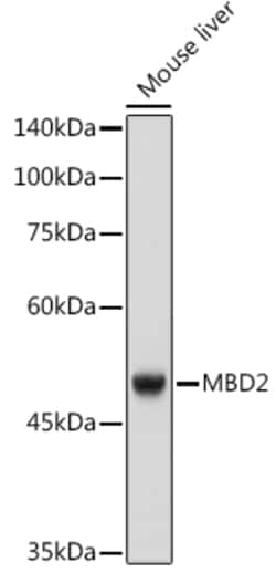 Invitrogen MBD2 Recombinant Rabbit Monoclonal Antibody (4D4D5) 100 &mu;L | Buy Online | Invitrogen&trade; | Fisher Scientific