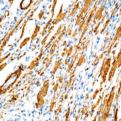 Invitrogen MYH11 Recombinant Rabbit Monoclonal Antibody (0O4O4) 100 &mu;L;