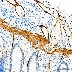 Invitrogen MYH11 Recombinant Rabbit Monoclonal Antibody (0O4O4) 100 &mu;L;