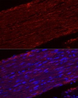 Invitrogen MYH11 Recombinant Rabbit Monoclonal Antibody (0O4O4) 100 &mu;L;