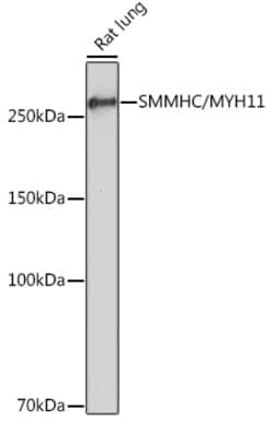 Invitrogen MYH11 Recombinant Rabbit Monoclonal Antibody (0O4O4) 100 &mu;L;