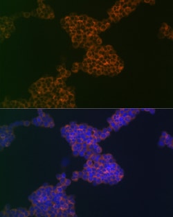Invitrogen CD3g Recombinant Rabbit Monoclonal Antibody (7J2L5) 100 &mu;L;