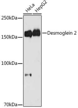 Invitrogen Desmoglein 2 (DSG2) Recombinant Rabbit Monoclonal Antibody (8O0R6)