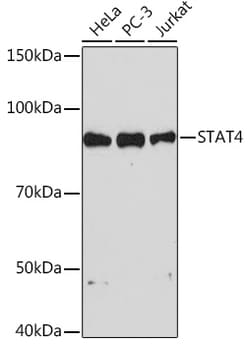 Invitrogen STAT4 Recombinant Rabbit Monoclonal Antibody (10H10O9) 100 &mu;L | Buy Online | Invitrogen&trade; | Fisher Scientific