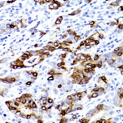 Invitrogen TFF3 Recombinant Rabbit Monoclonal Antibody (7X6O2) 100 &mu;L;