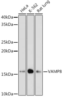 Invitrogen VAMP8 Recombinant Rabbit Monoclonal Antibody (5H9S4) 100 &mu;L;