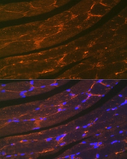 Invitrogen Dystrophin Recombinant Rabbit Monoclonal Antibody (10G10K7)