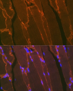Invitrogen Dystrophin Recombinant Rabbit Monoclonal Antibody (10G10K7)