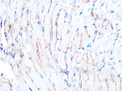 Invitrogen Dystrophin Recombinant Rabbit Monoclonal Antibody (10G10K7)