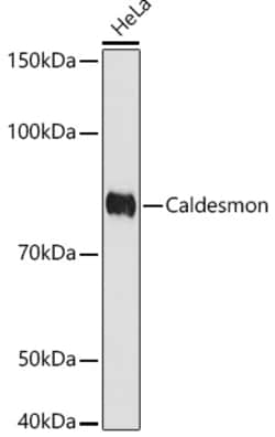 Invitrogen Caldesmon Recombinant Rabbit Monoclonal Antibody (6M5Q9) 100