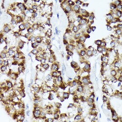 Invitrogen CDCA3 Recombinant Rabbit Monoclonal Antibody (1J5L2) 100 &mu;L;