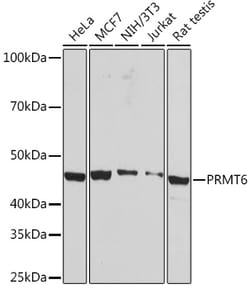 Invitrogen PRMT6 Recombinant Rabbit Monoclonal Antibody (1Z10L6) 100 &mu;L;