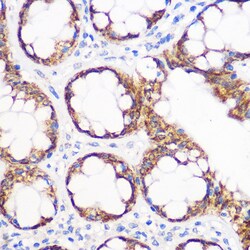 Invitrogen IGF2BP2 Recombinant Rabbit Monoclonal Antibody (2O3W8) 100 &mu;L;
