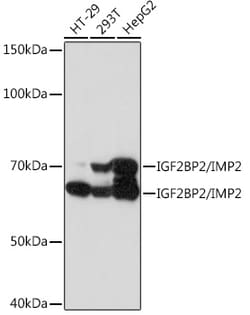 Invitrogen IGF2BP2 Recombinant Rabbit Monoclonal Antibody (2O3W8) 100 &mu;L;