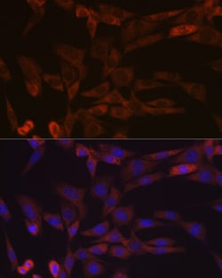 Invitrogen Activin A Recombinant Rabbit Monoclonal Antibody (1X6N9) 100