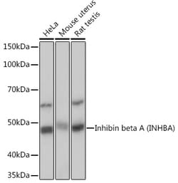 Invitrogen Activin A Recombinant Rabbit Monoclonal Antibody (1X6N9) 100