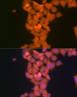 Invitrogen p53DINP1 Recombinant Rabbit Monoclonal Antibody (9Y6Z7) 100