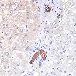 Invitrogen p53DINP1 Recombinant Rabbit Monoclonal Antibody (9Y6Z7) 100