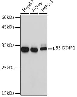 Invitrogen p53DINP1 Recombinant Rabbit Monoclonal Antibody (9Y6Z7) 100