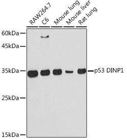 Invitrogen p53DINP1 Recombinant Rabbit Monoclonal Antibody (9Y6Z7) 100