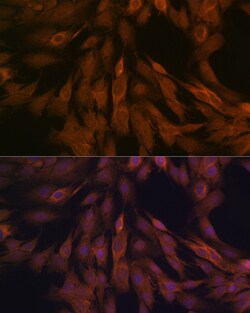 Invitrogen ULK3 Recombinant Rabbit Monoclonal Antibody (5Z7Z6) 100 &mu;L;