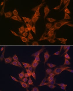 Invitrogen ULK3 Recombinant Rabbit Monoclonal Antibody (5Z7Z6) 100 &mu;L;