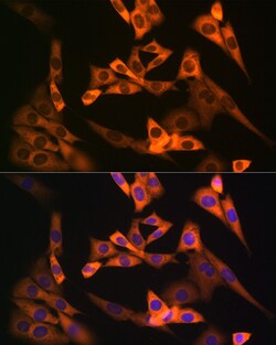Invitrogen NAP1L1 Recombinant Rabbit Monoclonal Antibody (4W8B6) 100 &mu;L;