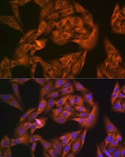 Invitrogen NAP1L1 Recombinant Rabbit Monoclonal Antibody (4W8B6) 100 &mu;L;